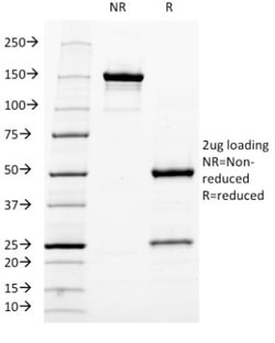 Mouse anti-NF-H, Clone: RT-97, Novus Biologicals 0.2mg; Unlabeled:Antibodies,